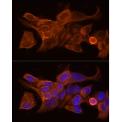 WAP Four Disulfide Core Domain Protein 2 (WFDC2) Antibody