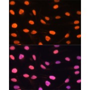 Immunofluorescence analysis of U-2 OS cells using ZBED1 Antibody (1/100 dilution). Blue: DAPI for nuclear staining.