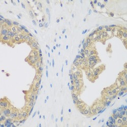 Glutamyl Aminopeptidase (Aminopeptidase A) (ENPEP) Antibody