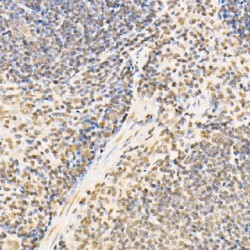 Protein SSXT (SS18) Antibody