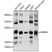 Western blot analysis of extracts of various cell lines using RAB9A Antibody (1/1000 dilution).