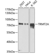 Western blot analysis of extracts of various cell lines using TRMT2A Antibody (1/1000 dilution).
