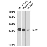 Western blot analysis of extracts of various cell lines using BNIP1 Antibody (1/1000 dilution).