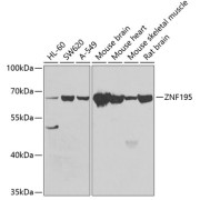 Western blot analysis of extracts of various cell lines using ZNF195 Antibody (1/1000 dilution).