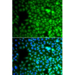 Zinc Finger Protein 195 (ZNF195) Antibody