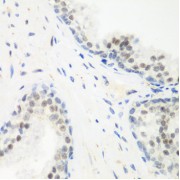 Immunohistochemistry of paraffin-embedded Human prostate using PPAN Antibody (1/200 dilution, 40x lens).