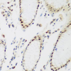 Peter Pan Homolog (Drosophila) (PPAN) Antibody