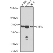 Western blot analysis of extracts of various cell lines using C4BPA Antibody (1/1000 dilution).