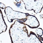 Immunohistochemistry of paraffin-embedded human placenta using GH1 Antibody (1/50 dilution, 40x lens). High pressure antigen retrieval was performed in 10 mM citrate buffer pH 6.0 before commencing with IHC staining protocol.