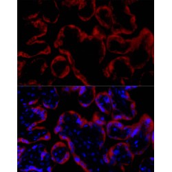 Somatotropin / Growth Hormone (GH1) Antibody