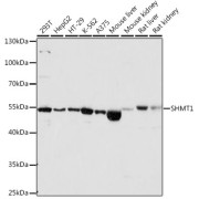 Western blot analysis of extracts of various cell lines using SHMT1 Antibody (1/1000 dilution).