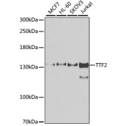 Western blot analysis of extracts of various cell lines using TTF2 Antibody (1/1000 dilution).