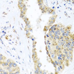 Aspartate-tRNA Ligase, Mitochondrial (DARS2) Antibody