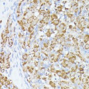 Immunohistochemistry of paraffin-embedded Rat ovary using ACAT2 Antibody (1/100 dilution, 40x lens).