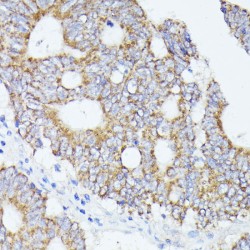 Acetyl Coenzyme A Acetyltransferase 2 (ACAT2) Antibody