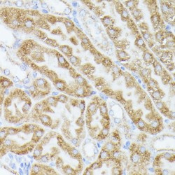 Acetyl Coenzyme A Acetyltransferase 2 (ACAT2) Antibody
