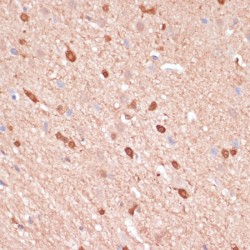 Acetyl Coenzyme A Acetyltransferase 2 (ACAT2) Antibody