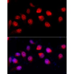 Double-Stranded RNA-Specific Adenosine Deaminase (ADAR) Antibody