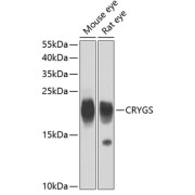 Western blot analysis of extracts of various cell lines using CRYGS Antibody (1/400 dilution)0.