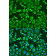 Immunofluorescence analysis of U2OS cells using KIF11 Antibody (1/100 dilution). Blue: DAPI for nuclear staining.