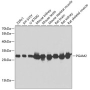 Western blot analysis of extracts of various cell lines using PGAM2 Antibody (1/1000 dilution).