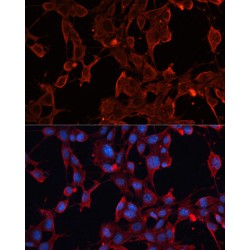 ADAM Metallopeptidase Domain 12 (ADAM12) Antibody