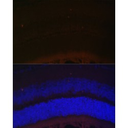 11-Cis Retinol Dehydrogenase (RDH5) Antibody