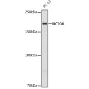 Western blot analysis of extracts of PC-12 cells using RICTOR Antibody (1/500 dilution).