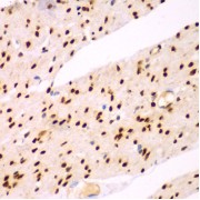Immunohistochemistry of paraffin-embedded Human colon using TEAD3 Antibody (1/100 dilution, 40x lens).