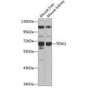 Western blot analysis of extracts of various cell lines using TESK2 Antibody (1/1000 dilution).