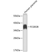 Western blot analysis of extracts of Human placenta using FCGR2B Antibody (1/1000 dilution).