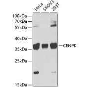 Western blot analysis of extracts of various cell lines using CENPK Antibody (1/1000 dilution).