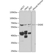 Western blot analysis of extracts of various cell lines using DGKE Antibody (1/1000 dilution).