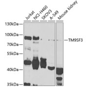 Western blot analysis of extracts of various cell lines using TM9SF3 Antibody (1/1000 dilution).