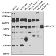 Western blot analysis of extracts of various cell lines using FERMT3 Antibody (1/1000 dilution).