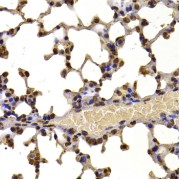 Immunohistochemistry of paraffin-embedded Mouse lung using WHSC1 Antibody (1/100 dilution, 40x lens).