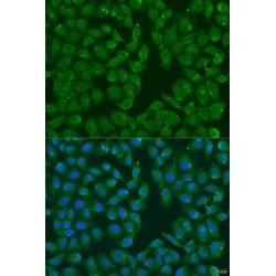 Methionine-R-Sulfoxide Reductase B3 (MSRB3) Antibody