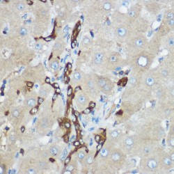 Calpain-2 Catalytic Subunit (CAPN2) Antibody