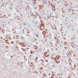 Lysozyme C (LYZ) Antibody