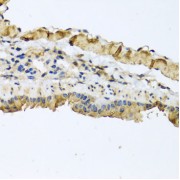 Immunohistochemistry of paraffin-embedded Mouse lung using ATP2C1 Antibody (1/100 dilution, 40x lens).