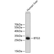 Western blot analysis of extracts of human liver using BTG3 Antibody