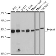 Western blot analysis of extracts of various cell lines using Snail Antibody (1/1000 dilution).