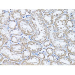 Snail Family Transcriptional Repressor 1 / SNAIL (SNAI1) Antibody