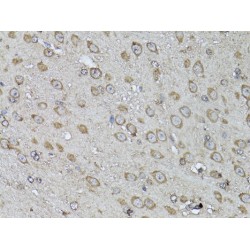 Snail Family Transcriptional Repressor 1 / SNAIL (SNAI1) Antibody
