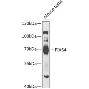 Western blot analysis of extracts of mouse testis using PIAS4 Antibody (1/1000 dilution).
