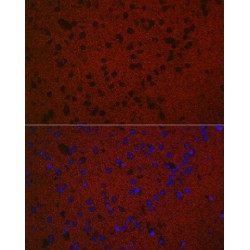 RAB3A, Member RAS Oncogene Family (RAB3A) Antibody