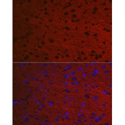 RAB3A, Member RAS Oncogene Family (RAB3A) Antibody