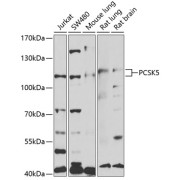 Western blot analysis of extracts of various cell lines using PCSK5 Antibody (1/1000 dilution).