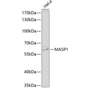 Western blot analysis of extracts of HeLa cells using MASP1 Antibody (1/1000 dilution).