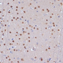 Apoptosis-Stimulating of p53 Protein 2 (TP53BP2) Antibody